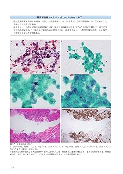 手技と細胞鑑別の完全攻略 実践的EUS-FNAアトラス 細胞検査士と